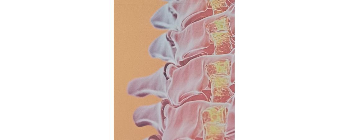 REHUMANIZACIÓN: Hablando de Osteoporosis y Humanizando la Reumatología