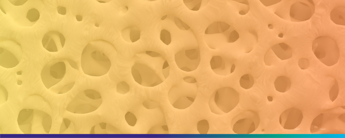 Osteoporosis: esa enfermedad silenciosa